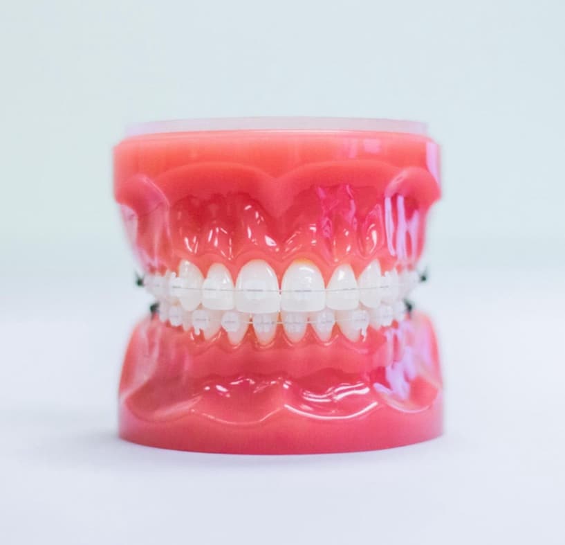 clear braces