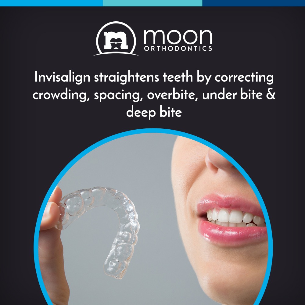 facts-on-invisalign