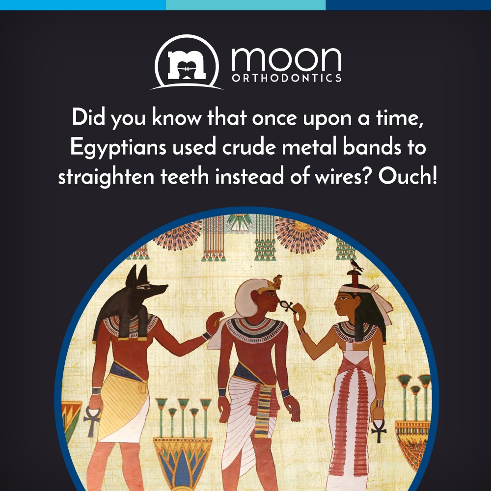 The History of Braces