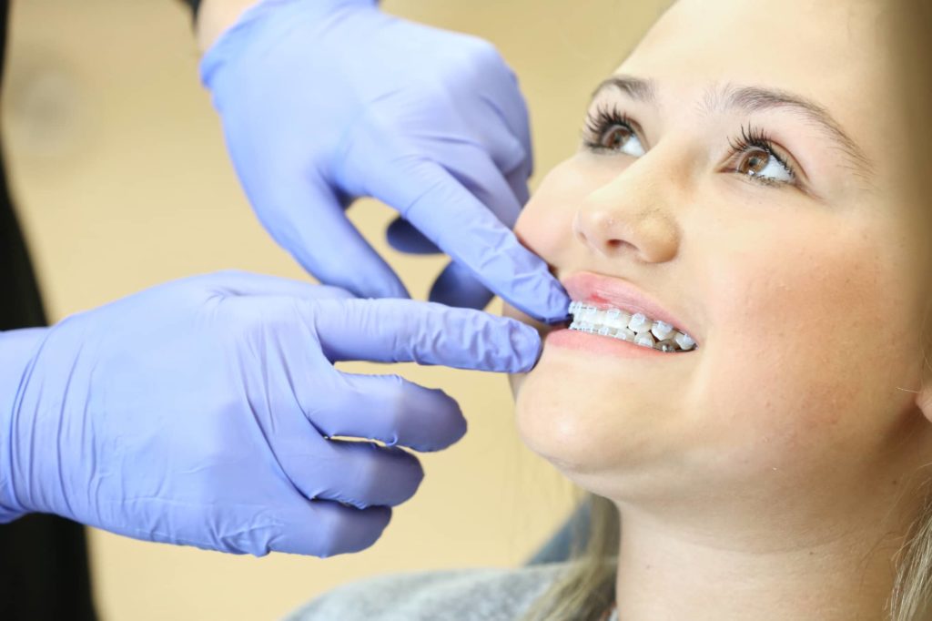 Life with Braces Overland Park Orthodontist Moon Orthodontics