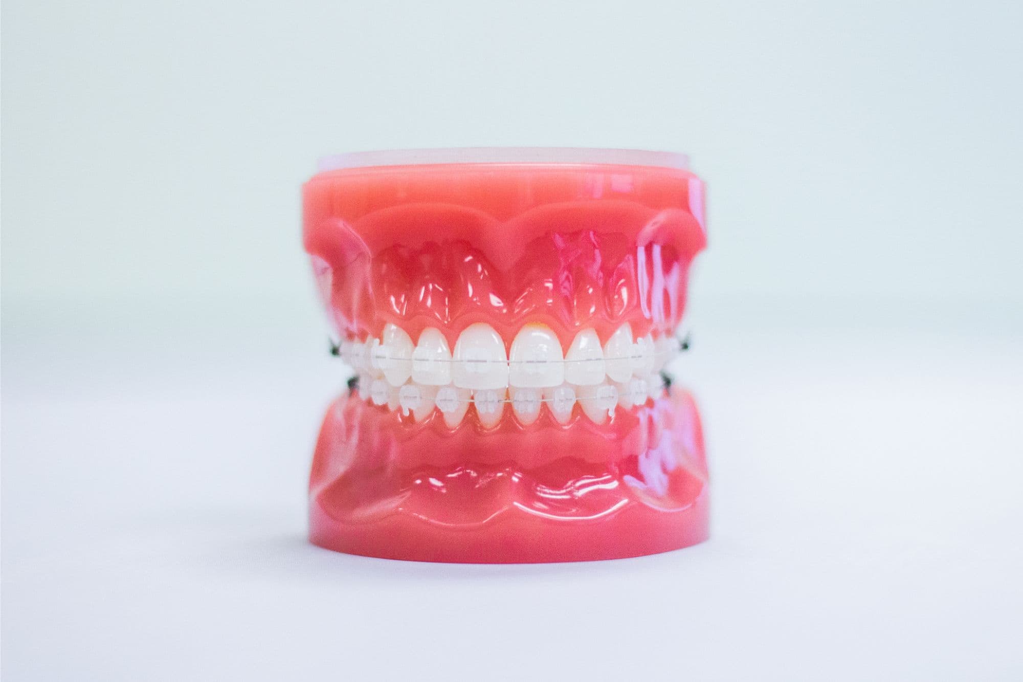 Metal, Clear and Ceramic Braces. What's the Difference?