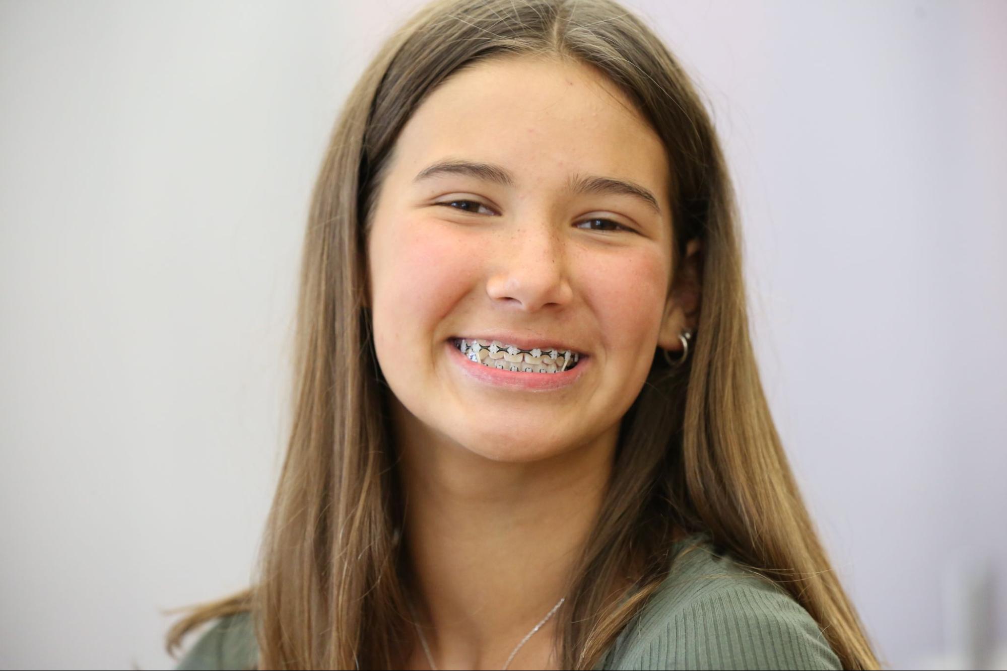How to Support Your Teen Through Orthodontic Treatment