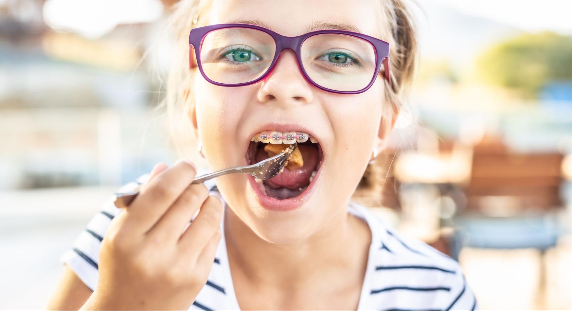 Your Guide to Healthy Dining in Overland Park While Wearing Braces