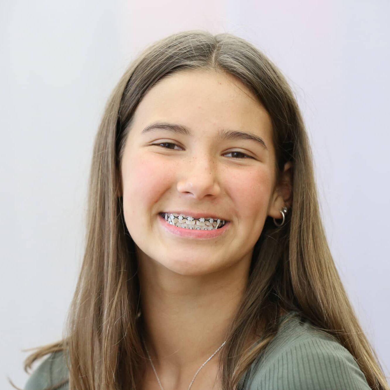 Overland Park KS Braces