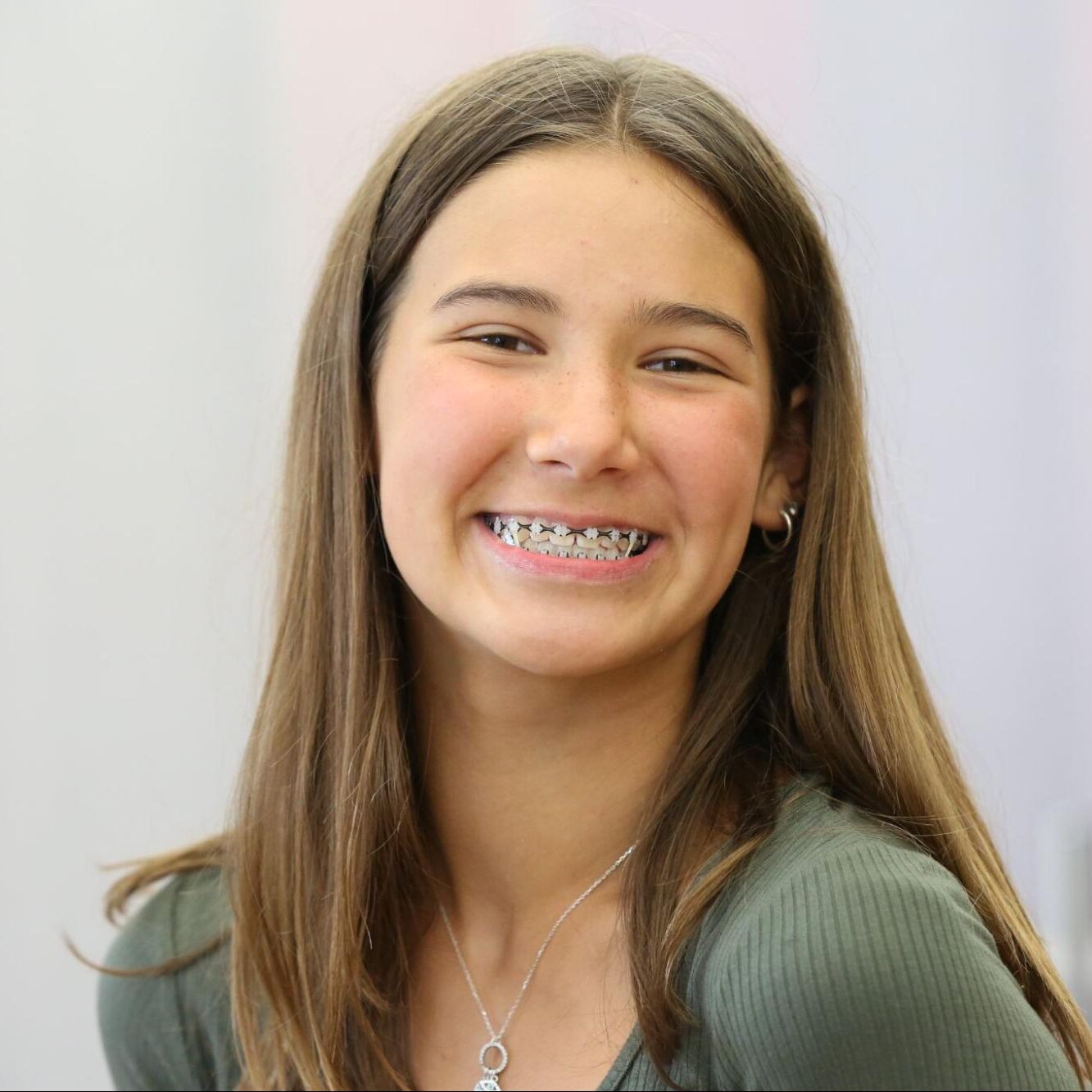 How Do Orthodontists Treat Overbites and Underbites?